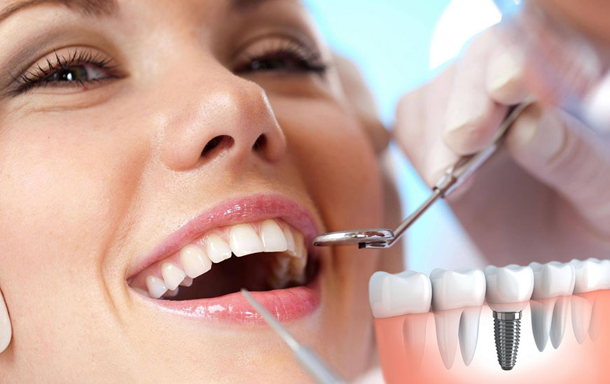 cosmetic dentist in Newcastle