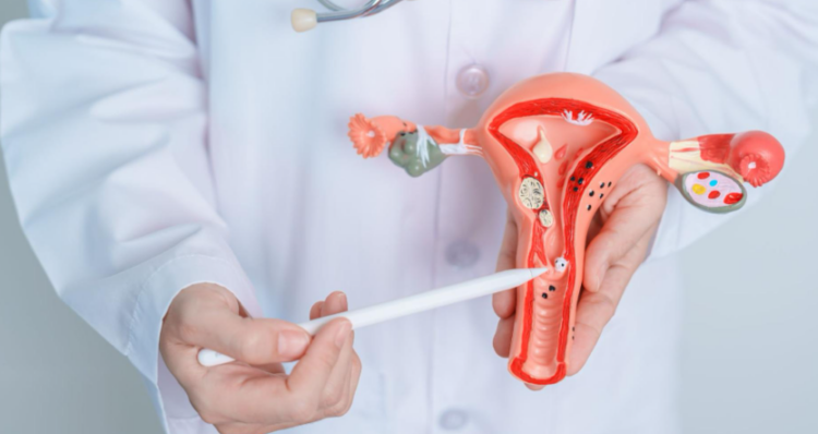 Uterine artery embolization