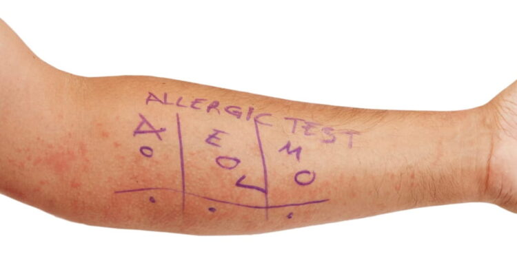 penicillin allergy testing