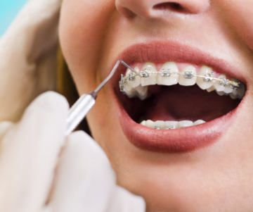orthodontic treatment Victoria