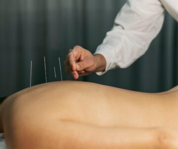 chinese medicine and acupuncture