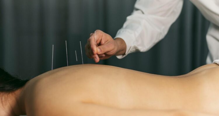 chinese medicine and acupuncture