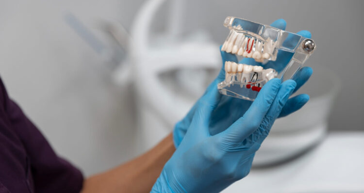 Hughson Dental Implants
